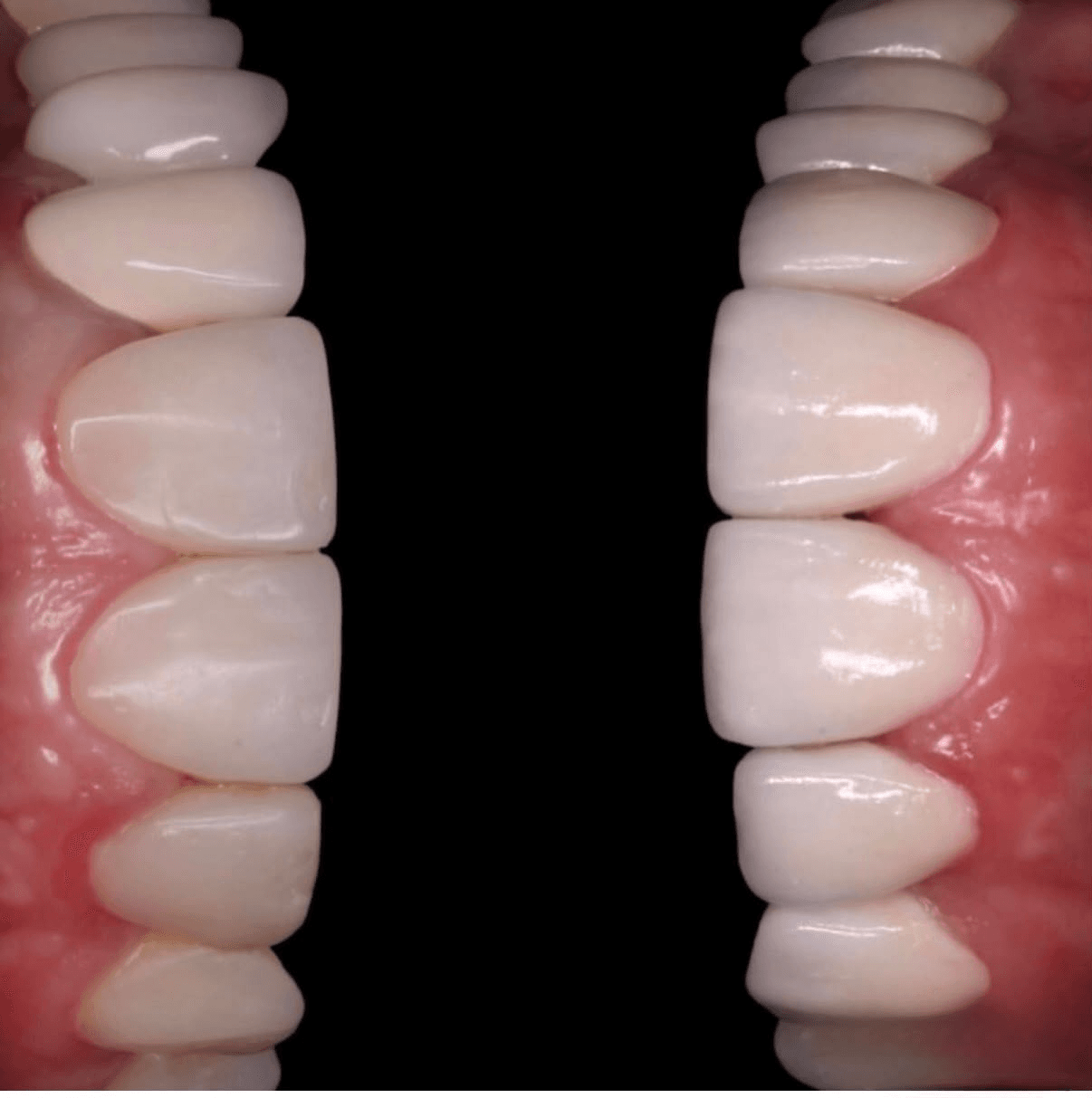 Estética Dental - Imagen 1